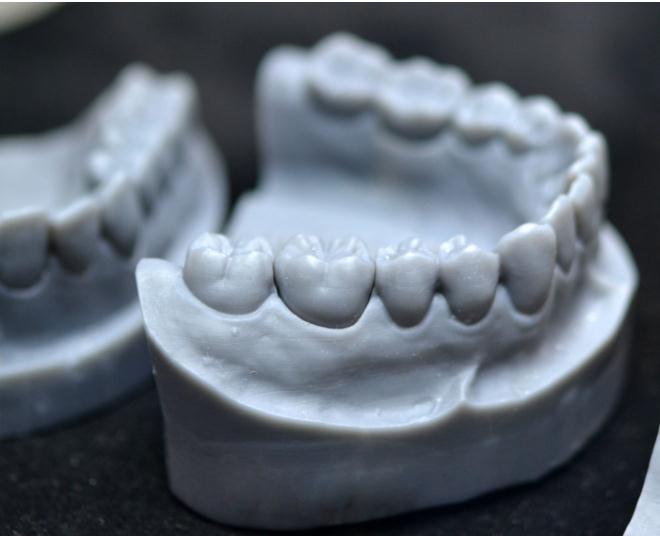 Digital Dentistry and 3D Printing